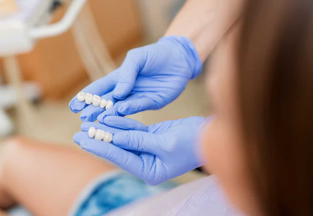 Learn The Basics Of Dental Bridges