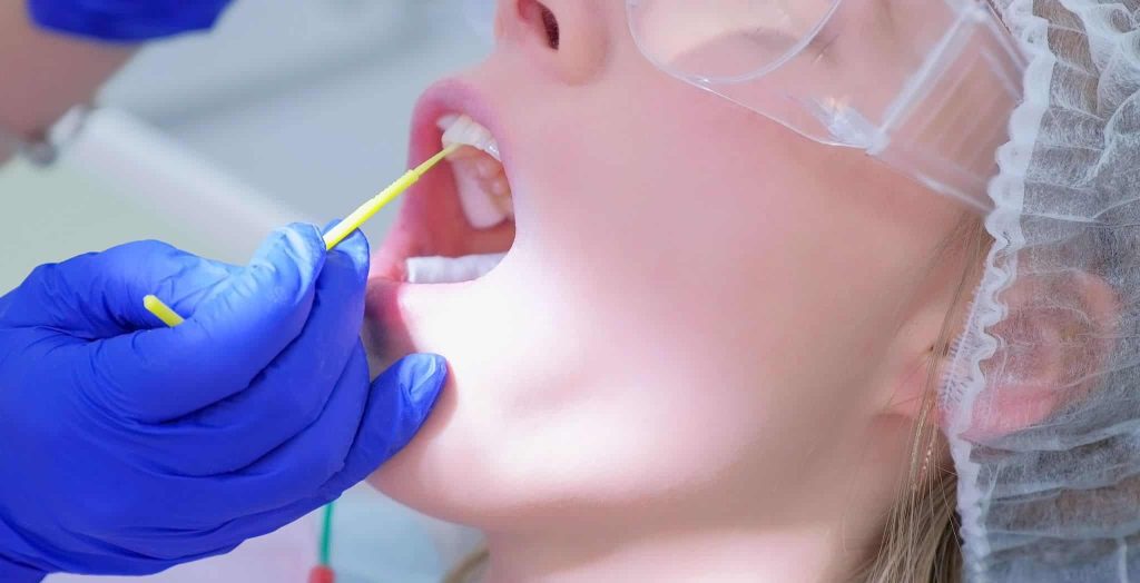 Fluoride tooth varnish, Dental fluoride varnish, Fluoride varnish treatment
